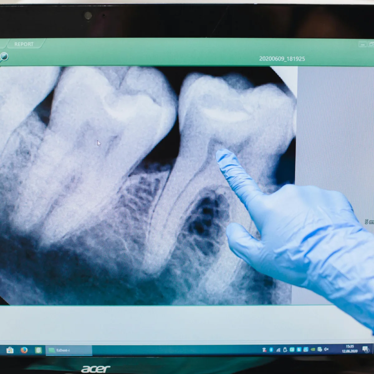Dental Technology at Dr. Jane Yang DDS in Denver, Colorado